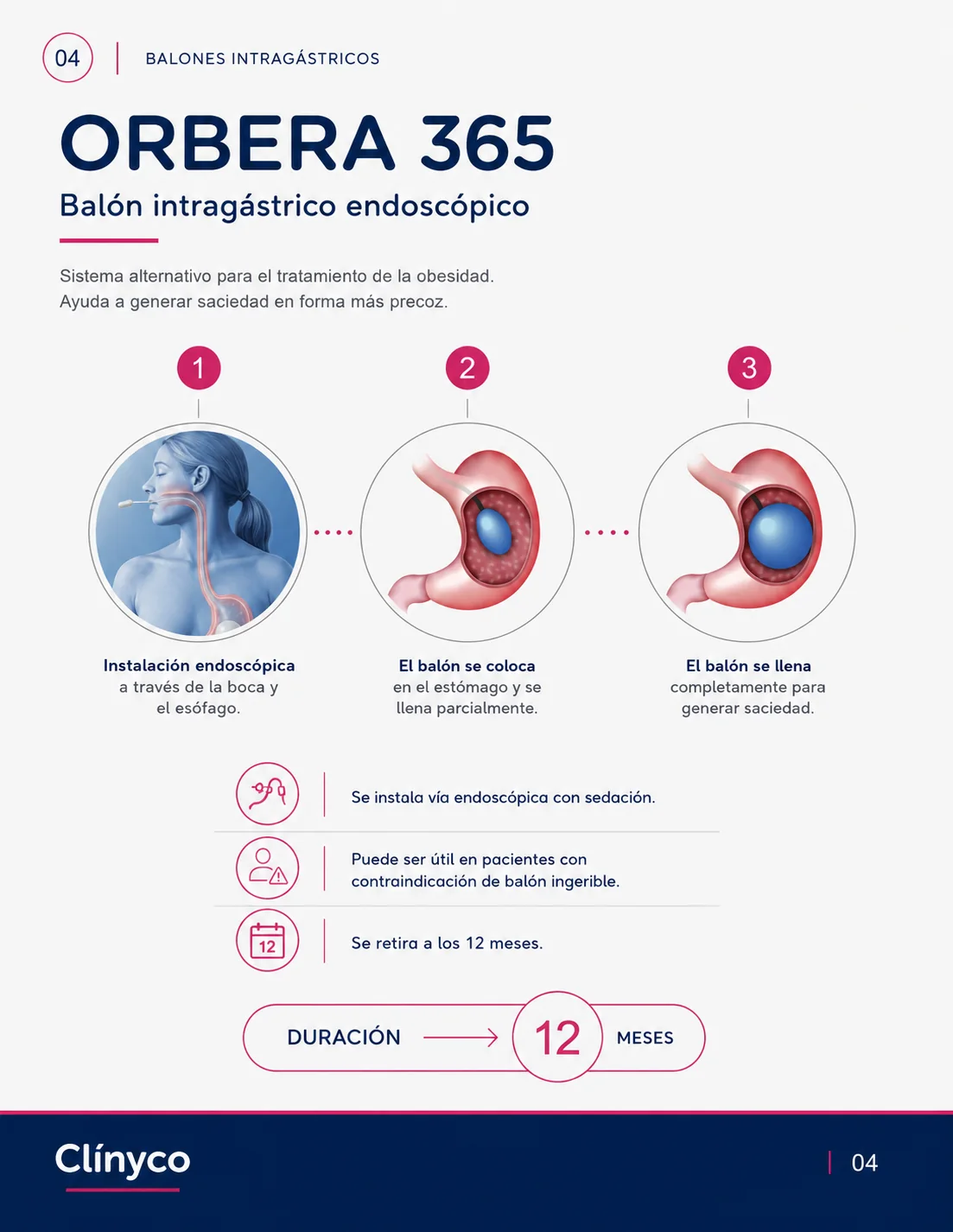 Orbera 365