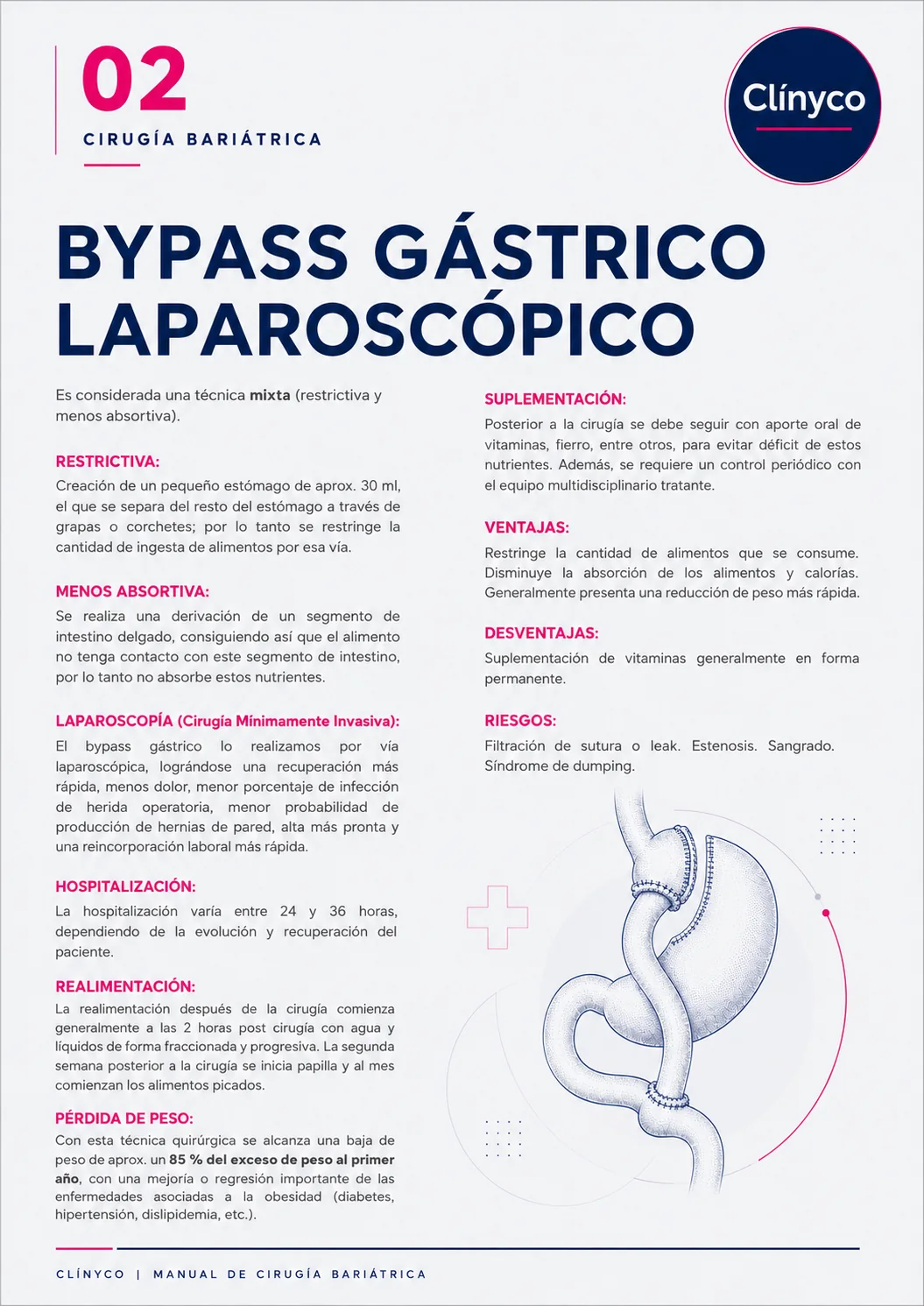 Bypass gástrico