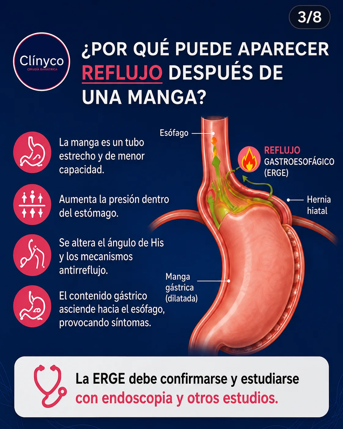 Reflujo después de manga